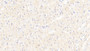 DAB staining on IHC-P; Sample: Human Cardiac Muscle Tissue; Primary Ab: 20ug/ml Mouse Anti-Human IL18 Antibody; Second Ab: 2ug/mL HRP-Linked Caprine Anti-Mouse IgG Polyclonal Antibody