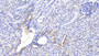 DAB staining on IHC-P; Sample: Human Kidney Tissue; Primary Ab: 20ug/ml Mouse Anti-Human TGFa Antibody Second Ab: 2ug/mL HRP-Linked Caprine Anti-Mouse IgG Polyclonal Antibody