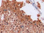 DAB staining on IHC-P; Sample: Human Liver Tissue; Primary Ab: 10ug/ml Mouse Anti-Human Arg Antibody Second Ab: 2ug/mL HRP-Linked Caprine Anti-Mouse IgG Polyclonal Antibody