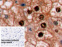 DAB staining on IHC-P; Sample: Human Liver Tissue; Primary Ab: 10ug/ml Mouse Anti-Human Arg Antibody; Control: Used PBS instead of primary antibody; Second Ab: 2ug/ml HRP-Linked Caprine Anti-Mouse IgG Polyclonal Antibody