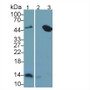 Western Blot Sample: Lane1: Human Urine; Lane2: A431 cell lysate; Lane3: Raji cell lysate Primary Ab: 2ug/ml Mouse Anti-Human b2M Antibody Second Ab: 0.2ug/mL HRP-Linked Caprine Anti-Mouse IgG Polyclonal Antibody