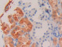 DAB staining on IHC-P; Sample: Human Kidney Tissue; Primary Ab: 30ug/ml Mouse Anti-Human RBP4 Antibody Second Ab: 2ug/mL HRP-Linked Caprine Anti-Mouse IgG Polyclonal Antibody