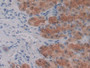 DAB staining on IHC-P; Sample: Rat Stomach Tissue; Primary Ab: 30ug/ml Mouse Anti-Rat CTGF Antibody Second Ab: 2ug/mL HRP-Linked Caprine Anti-Mouse IgG Polyclonal Antibody