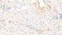 DAB staining on IHC-P; Sample: Human Placenta Tissue; Primary Ab: 10ug/ml Mouse Anti-Human FGb Antibody Second Ab: 2ug/mL HRP-Linked Caprine Anti-Mouse IgG Polyclonal Antibody