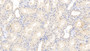 DAB staining on IHC-P; Sample: Human Kidney Tissue; Primary Ab: 10ug/ml Mouse Anti-Human FGb Antibody; Second Ab: 2ug/mL HRP-Linked Caprine Anti-Mouse IgG Polyclonal Antibody