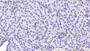 DAB staining on IHC-P; Sample: Human Kidney Tissue; Primary Ab: 20ug/ml Mouse Anti-Human ADP Antibody Second Ab: 2ug/mL HRP-Linked Caprine Anti-Mouse IgG Polyclonal Antibody