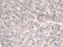 DAB staining on IHC-P; Sample: Human Liver Tissue; Primary Ab: 30ug/ml Mouse Anti-Human a1BG Antibody Second Ab: 2ug/mL HRP-Linked Caprine Anti-Mouse IgG Polyclonal Antibody