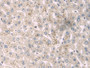 DAB staining on IHC-P; Sample: Human Liver Tissue; Primary Ab: 30ug/ml Mouse Anti-Human a1BG Antibody; Second Ab: 2ug/mL HRP-Linked Caprine Anti-Mouse IgG Polyclonal Antibody