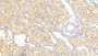 DAB staining on IHC-P; Sample: Human Kidney Tissue; Primary Ab: 30ug/ml Mouse Anti-Human FABP4 Antibody Second Ab: 2ug/mL HRP-Linked Caprine Anti-Mouse IgG Polyclonal Antibody