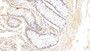 DAB staining on IHC-P; Sample: Human Colon Tissue; Primary Ab: 30ug/ml Mouse Anti-Human FABP4 Antibody; Second Ab: 2ug/mL HRP-Linked Caprine Anti-Mouse IgG Polyclonal Antibody