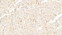 DAB staining on IHC-P; Sample: Human Cardiac Muscle Tissue; Primary Ab: 30ug/ml Mouse Anti-Human FABP4 Antibody; Second Ab: 2ug/mL HRP-Linked Caprine Anti-Mouse IgG Polyclonal Antibody