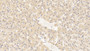 DAB staining on IHC-P; Sample: Human Liver Tissue; Primary Ab: 30ug/ml Mouse Anti-Human LSR Antibody Second Ab: 2ug/mL HRP-Linked Caprine Anti-Mouse IgG Polyclonal Antibody