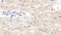 DAB staining on IHC-P; Sample: Human Cardiac Muscle Tissue; Primary Ab: 30ug/ml Mouse Anti-Human LSR Antibody; Second Ab: 2ug/mL HRP-Linked Caprine Anti-Mouse IgG Polyclonal Antibody