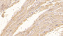 DAB staining on IHC-P; Sample: Human Cardiac Muscle Tissue; Primary Ab: 40ug/ml Mouse Anti-Human CTGF Antibody Second Ab: 2ug/mL HRP-Linked Caprine Anti-Mouse IgG Polyclonal Antibody