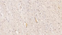 DAB staining on IHC-P; Sample: Human Cerebrum Tissue; Primary Ab: 20ug/ml Mouse Anti-Human MOG Antibody Second Ab: 2ug/mL HRP-Linked Caprine Anti-Mouse IgG Polyclonal Antibody