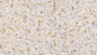 DAB staining on IHC-P; Sample: Human Liver Tissue; Primary Ab: 10ug/ml Mouse Anti-Human APOA1 Antibody; Second Ab: 2ug/mL HRP-Linked Caprine Anti-Mouse IgG Polyclonal Antibody