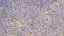 DAB staining on IHC-P; Sample: Human Spleen Tissue; Primary Ab: 10ug/ml Mouse Anti-Human AT Antibody; Second Ab: 2ug/mL HRP-Linked Caprine Anti-Mouse IgG Polyclonal Antibody