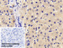 DAB staining on IHC-P; Sample: Human Liver Tissue; Primary Ab: 20ug/ml Mouse Anti-Human AT Antibody; Control: Used PBS instead of primary antibody; Second Ab: 2ug/ml HRP-Linked Caprine Anti-Mouse IgG Polyclonal Antibody