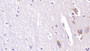 DAB staining on IHC-P; Sample: Human Cerebrum Tissue; Primary Ab: 40ug/ml Mouse Anti-Human AchE Antibody Second Ab: 2ug/mL HRP-Linked Caprine Anti-Mouse IgG Polyclonal Antibody