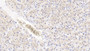 DAB staining on IHC-P; Sample: Human Liver Tissue; Primary Ab: 30ug/ml Mouse Anti-Human AchE Antibody Second Ab: 2ug/mL HRP-Linked Caprine Anti-Mouse IgG Polyclonal Antibody