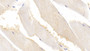 DAB staining on IHC-P; Sample: Human Skeletal muscle Tissue; Primary Ab: 30ug/ml Mouse Anti-Human AchE Antibody Second Ab: 2ug/mL HRP-Linked Caprine Anti-Mouse IgG Polyclonal Antibody