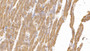 DAB staining on IHC-P; Sample: Human Cardiac Muscle Tissue; Primary Ab: 10ug/ml Mouse Anti-Human SEMA5B Antibody; Second Ab: 2ug/mL HRP-Linked Caprine Anti-Mouse IgG Polyclonal Antibody
