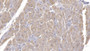 DAB staining on IHC-P; Sample: Human Cardiac Muscle Tissue; Primary Ab: 10ug/ml Mouse Anti-Human SEMA5B Antibody Second Ab: 2ug/mL HRP-Linked Caprine Anti-Mouse IgG Polyclonal Antibody