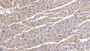 DAB staining on IHC-P; Sample: Human Cardiac Muscle Tissue; Primary Ab: 10ug/ml Mouse Anti-Human SEMA5B Antibody Second Ab: 2ug/mL HRP-Linked Caprine Anti-Mouse IgG Polyclonal Antibody
