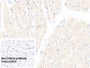 DAB staining on IHC-P; Sample: Porcine Cardiac Muscle Tissue; Primary Ab: 10ug/ml Mouse Anti-Human TNNT2 Antibody; Control: Used PBS instead of primary antibody; Second Ab: 2ug/ml HRP-Linked Caprine Anti-Mouse IgG Polyclonal Antibody