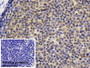 DAB staining on IHC-P; Sample: Porcine Lymph node Tissue; Primary Ab: 20ug/ml Mouse Anti-Human CYPB Antibody; Control: Used PBS instead of primary antibody; Second Ab: 2ug/ml HRP-Linked Caprine Anti-Mouse IgG Polyclonal Antibody