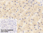 DAB staining on IHC-P; Sample: Human Liver Tissue; Primary Ab: 20ug/ml Mouse Anti-Human a2PI Antibody; Control: Used PBS instead of primary antibody; Second Ab: 2ug/ml HRP-Linked Caprine Anti-Mouse IgG Polyclonal Antibody