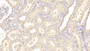 DAB staining on IHC-P; Sample: Porcine Kidney Tissue; Primary Ab: 20ug/ml Mouse Anti-Human HBEGF Antibody; Second Ab: 2ug/mL HRP-Linked Caprine Anti-Mouse IgG Polyclonal Antibody