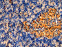 DAB staining on IHC-P; Sample: Porcine Pancreas Tissue; Primary Ab: 10ug/ml Mouse Anti-Human PKCe Antibody; Second Ab: 2ug/mL HRP-Linked Caprine Anti-Mouse IgG Polyclonal Antibody