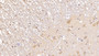 DAB staining on IHC-P; Sample: Rat Spinal cord Tissue; Primary Ab: 10ug/ml Mouse Anti-Rat ADP Antibody Second Ab: 2ug/mL HRP-Linked Caprine Anti-Mouse IgG Polyclonal Antibody