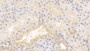DAB staining on IHC-P; Sample: Human Kidney Tissue; Primary Ab: 20ug/ml Mouse Anti-Human TNC Antibody; Second Ab: 2ug/mL HRP-Linked Caprine Anti-Mouse IgG Polyclonal Antibody