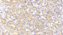 DAB staining on IHC-P; Sample: Human Stomach Tissue; Primary Ab: 20ug/ml Mouse Anti-Human TNC Antibody; Second Ab: 2ug/mL HRP-Linked Caprine Anti-Mouse IgG Polyclonal Antibody