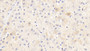 DAB staining on IHC-P; Sample: Human Liver Tissue; Primary Ab: 20ug/ml Mouse Anti-Human AT Antibody Second Ab: 2ug/mL HRP-Linked Caprine Anti-Mouse IgG Polyclonal Antibody