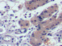 DAB staining on IHC-P; Sample: Human Stomach Tissue; Primary Ab: 10ug/ml Mouse Anti-Human aFP Antibody Second Ab: 2ug/mL HRP-Linked Caprine Anti-Mouse IgG Polyclonal Antibody