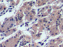 DAB staining on IHC-P; Sample: Human Stomach Tissue; Primary Ab: 10ug/ml Mouse Anti-Human aFP Antibody; Second Ab: 2ug/mL HRP-Linked Caprine Anti-Mouse IgG Polyclonal Antibody