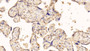 DAB staining on IHC-P; Sample: Human Placenta Tissue; Primary Ab: 10ug/ml Mouse Anti-Human IFNa/bR1 Antibody Second Ab: 2ug/mL HRP-Linked Caprine Anti-Mouse IgG Polyclonal Antibody