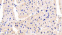 DAB staining on IHC-P; Sample: Human Cardiac Muscle Tissue; Primary Ab: 30ug/ml Mouse Anti-Human NT-ProANP Antibody; Second Ab: 2ug/mL HRP-Linked Caprine Anti-Mouse IgG Polyclonal Antibody