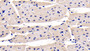 DAB staining on IHC-P; Sample: Human Cardiac Muscle Tissue; Primary Ab: 30ug/ml Mouse Anti-Human NT-ProANP Antibody; Second Ab: 2ug/mL HRP-Linked Caprine Anti-Mouse IgG Polyclonal Antibody