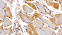 DAB staining on IHC-P; Sample: Human Skeletal muscle Tissue; Primary Ab: 30ug/ml Mouse Anti-Human NT-ProANP Antibody; Second Ab: 2ug/mL HRP-Linked Caprine Anti-Mouse IgG Polyclonal Antibody