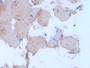 DAB staining on IHC-P; Sample: Rat Skin Tissue; Primary Ab: 30ug/ml Mouse Anti-Rat IL24 Antibody Second Ab: 2ug/mL HRP-Linked Caprine Anti-Mouse IgG Polyclonal Antibody
