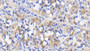 DAB staining on IHC-P; Sample: Human Stomach Tissue; Primary Ab: 20ug/ml Mouse Anti-Human FGF9 Antibody; Second Ab: 2ug/mL HRP-Linked Caprine Anti-Mouse IgG Polyclonal Antibody