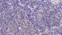 DAB staining on IHC-P; Samples: Porcine Spleen Tissue; Primary Ab: 40ug/ml Mouse Anti-Porcine IL6 Antibody Second Ab: 2ug/mL HRP-Linked Caprine Anti-Mouse IgG Polyclonal Antibody