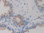 DAB staining on IHC-P; Sample: Human Prostate Tissue; Primary Ab: 30ug/ml Mouse Anti-Human IDH1 Antibody; Second Ab: 2ug/mL HRP-Linked Caprine Anti-Mouse IgG Polyclonal Antibody
