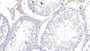 DAB staining on IHC-P; Sample: Rat Testis Tissue; Primary Ab: 10ug/ml Mouse Anti-Rat APOE Antibody; Second Ab: 2ug/mL HRP-Linked Caprine Anti-Mouse IgG Polyclonal Antibody