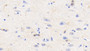 DAB staining on IHC-P; Sample: Human Cerebrum Tissue; Primary Ab: 20ug/ml Mouse Anti-Human CK-BB Antibody; Second Ab: 2ug/mL HRP-Linked Caprine Anti-Mouse IgG Polyclonal Antibody