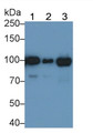 Western Blot; Sample: Lane1: Human Serum; Lane2: Human Plasma; Lane2: Human Placenta lysate Primary Ab: 0.04ug/ml Mouse Anti-Human ANG Antibody Second Ab: 0.2ug/mL HRP-Linked Caprine Anti-Mouse IgG Polyclonal Antibody